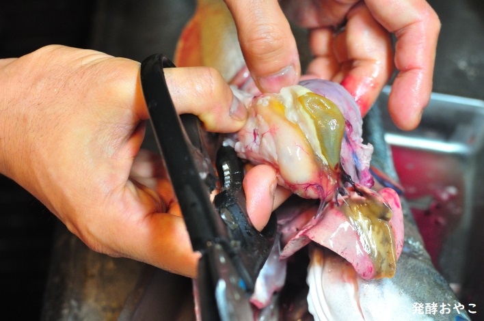 胆嚢を潰さないように取り出す