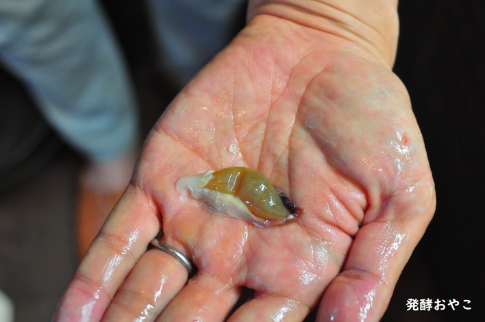 取り出した胆嚢